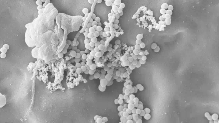 Bacteria repellent fabrics 720  405px